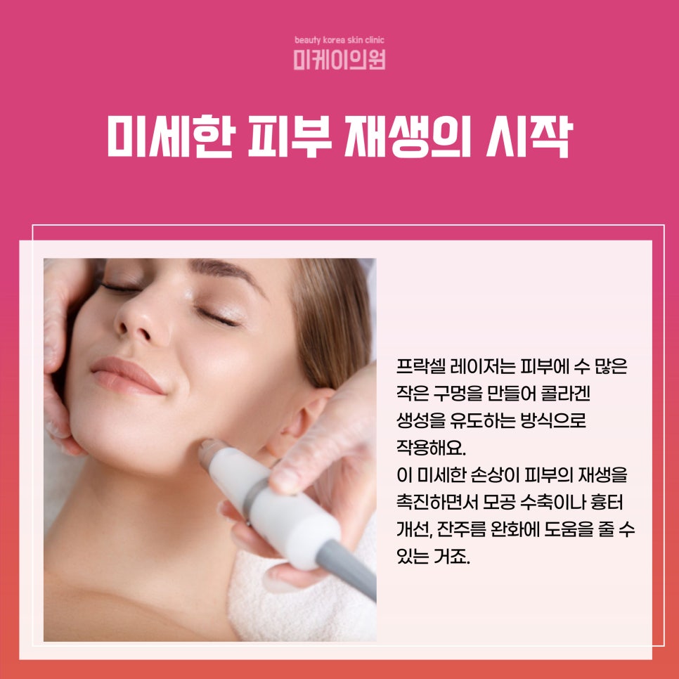 Seocho Fraxel: A New Trend in Skin Regeneration image 2
