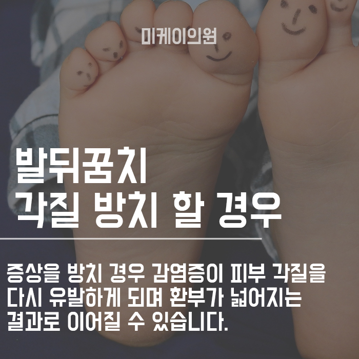 발뒤꿈치 갈라짐 원인 파악하고 해결해봐요! 관련 이미지 2