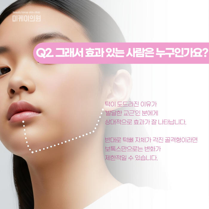 사각턱보톡스 효과 있는 사람, 따로 있을까? 관련 이미지 3