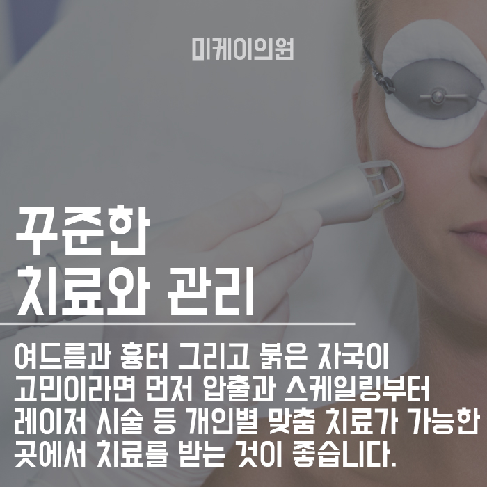 서초여드름의원 원인 그리고 치료방법에 대해 관련 이미지 4