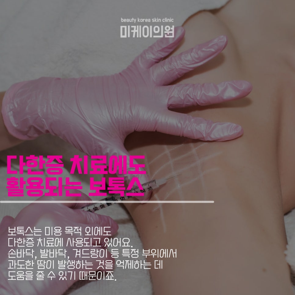 Gangnam Station Botox Duration Varies by Individual image 4