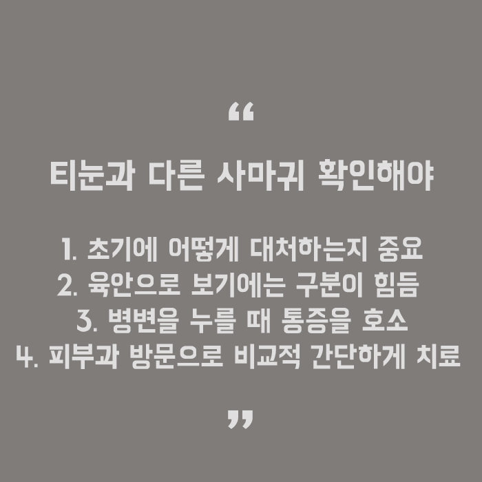 사마귀예방방법 어렵지 않은 이유 관련 이미지 5