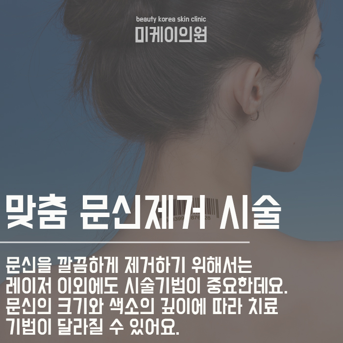 문신제거치료기간 미리 고려해요 관련 이미지 3