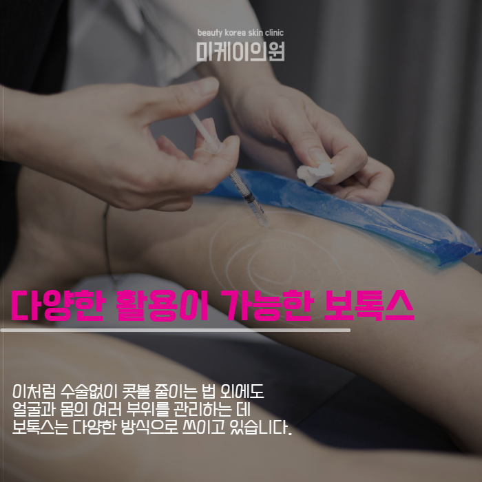 수술없이 콧볼 줄이는 법 콧볼 보톡스 관련 이미지 4