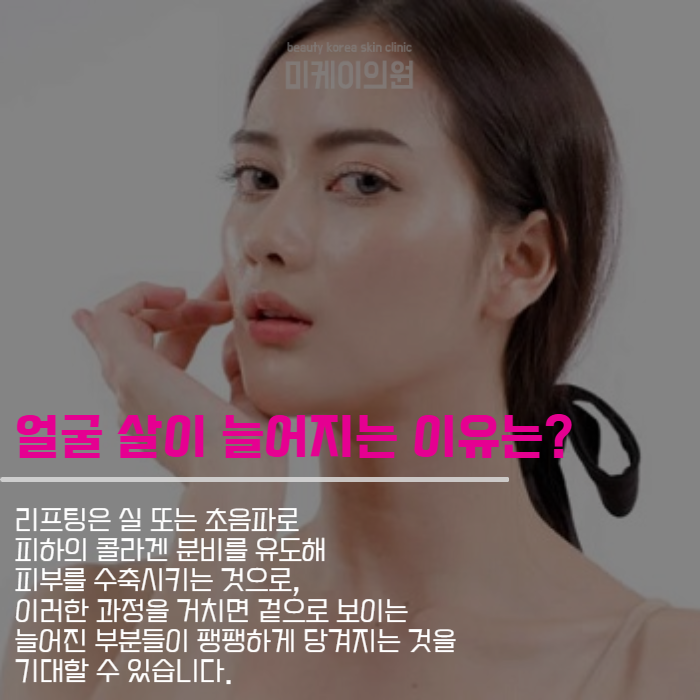 처진살리프팅 여러 가지 방식에 대해 관련 이미지 2