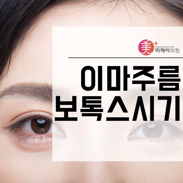 이마주름보톡스시기 개인에 따라 다를 수 있어 관련 이미지 1