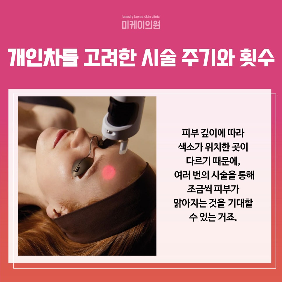 Dark Spots and Freckles Near Gangnam Station, Treat Them with Laser image 5