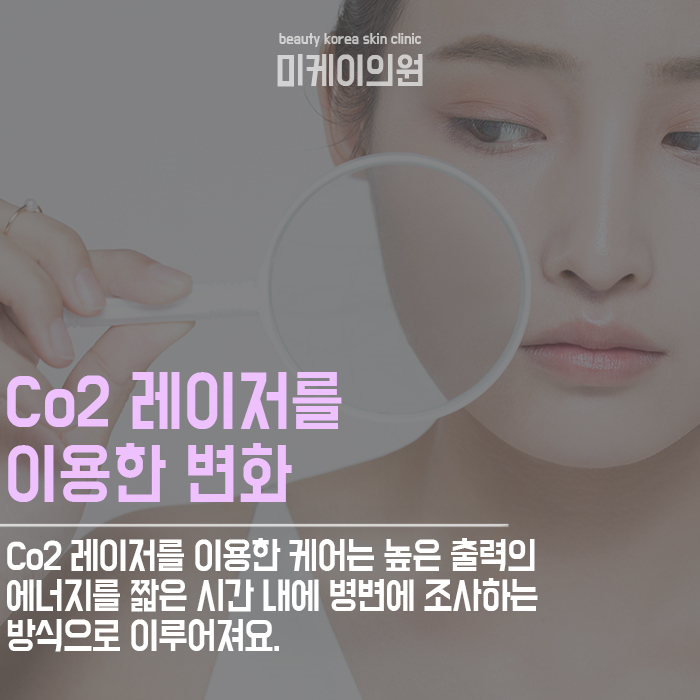 강남색소치료 어떤 레이저를 사용할까? 관련 이미지 3
