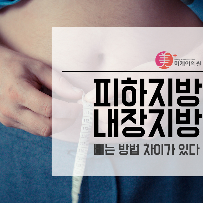 피하지방 내장지방 빼는 방법 차이가 있다? 관련 이미지 1