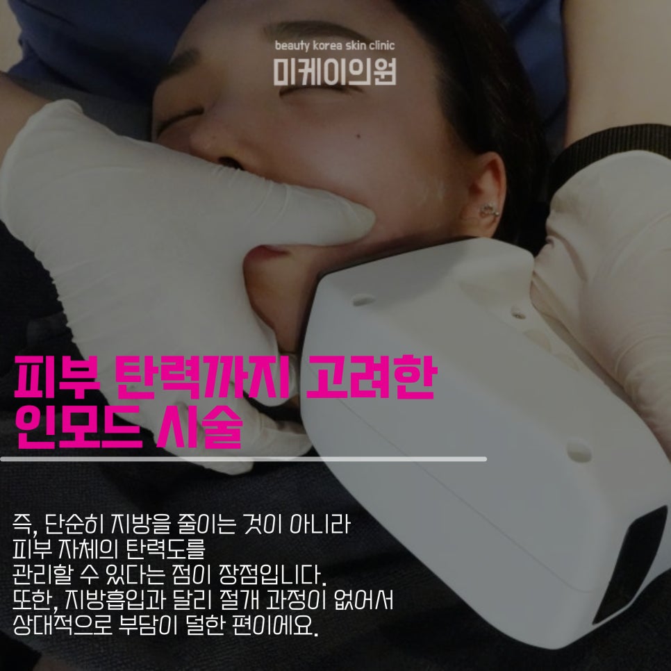 이중턱지방흡입부작용 피하려면 관련 이미지 2