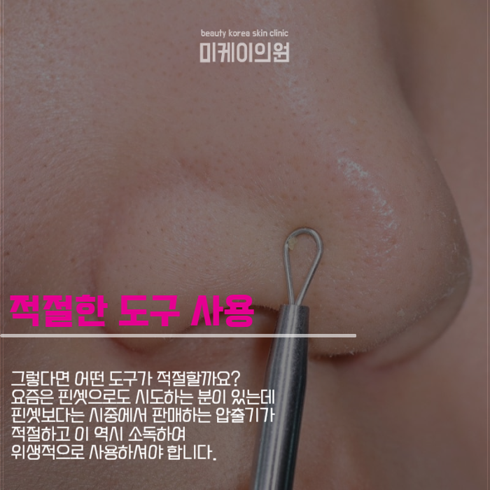 여드름 압출 방법 상처 생기지 않도록 관련 이미지 3