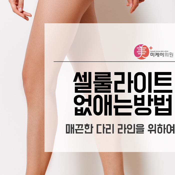 셀룰라이트 없애는방법 매끈한 다리 라인을 위하여 관련 이미지 1