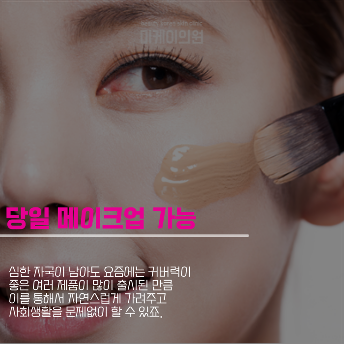인모드 멍 기간 짧게 끝내고 싶다면 관련 이미지 5