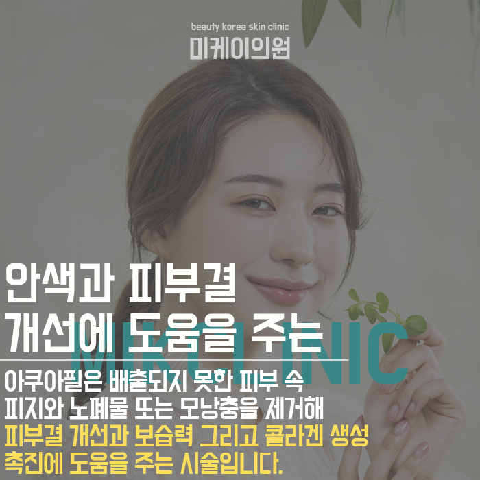 아쿠아필주의사항 개인에 따라 다를 수 있어요 관련 이미지 5