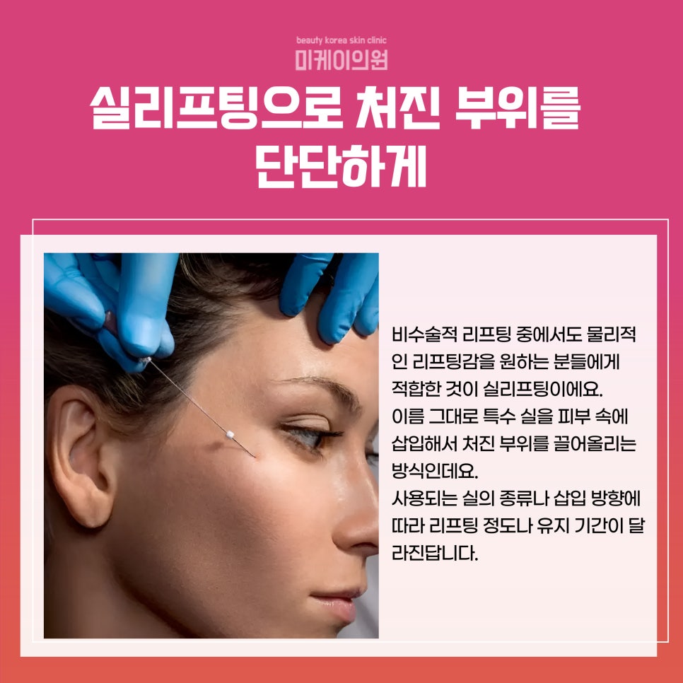 리프팅 종류 얼마나 다양할까 관련 이미지 4