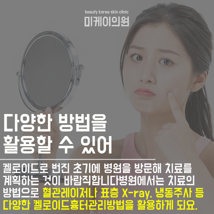 켈로이드흉터관리방법 어렵지 않아요 관련 이미지 4