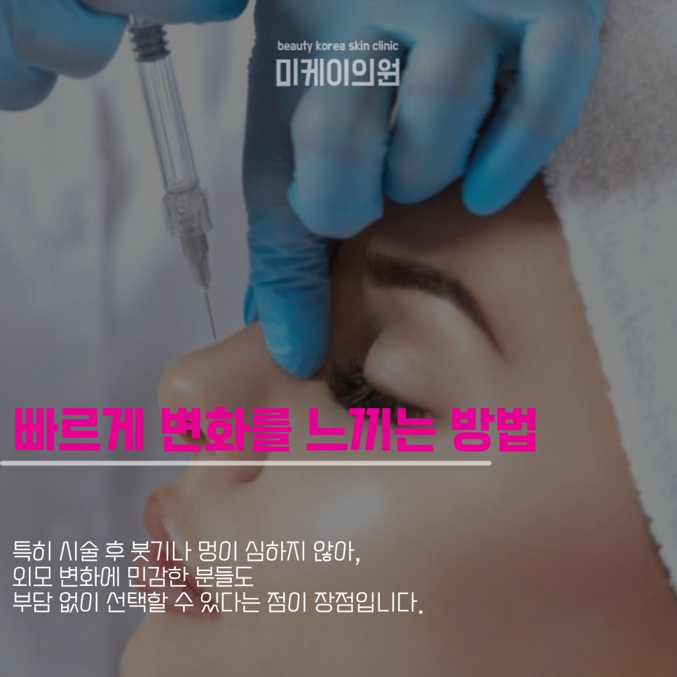 강남역 코필러로 첫인상 변화를 관련 이미지 2