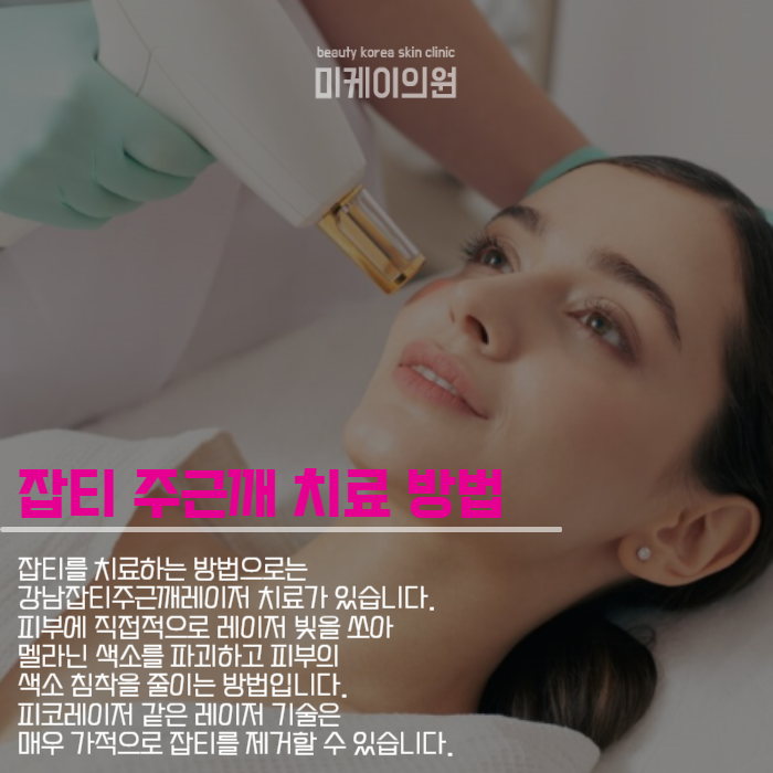 강남잡티주근깨레이저 정품으로 정량으로 관련 이미지 3