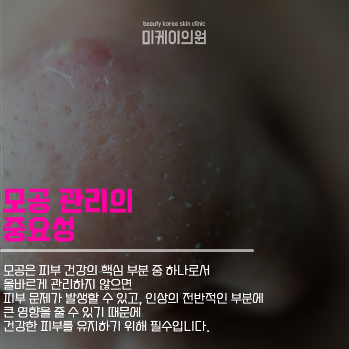 강남모공치료 깨끗하고 자신있는 얼굴 관련 이미지 2