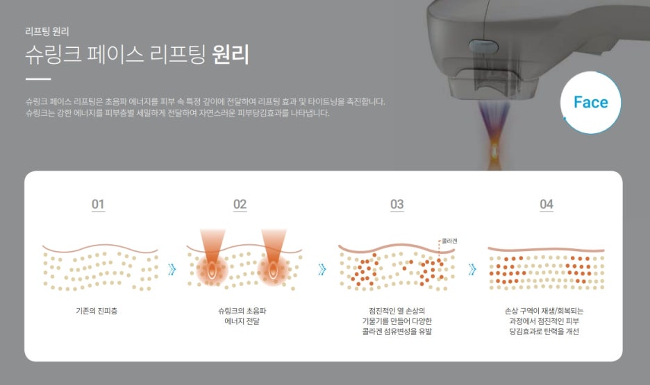 강남v라인슈링크300샷 부위별로 고민 해결! 관련 이미지 2