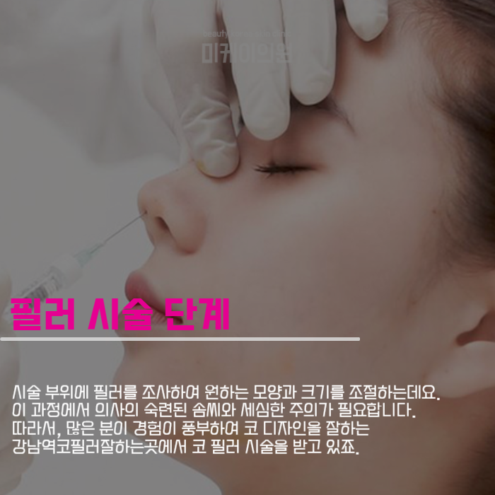 강남역코필러잘하는곳에서 맞춤형 시술을 관련 이미지 2