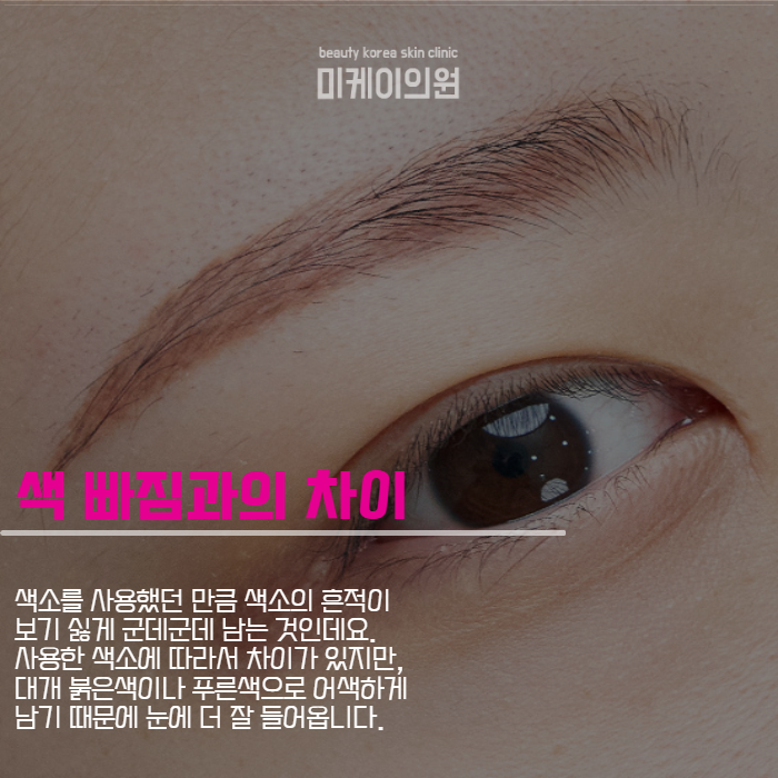 눈썹문신 잔흔없애는법 너무 신경 쓰인다면 관련 이미지 2