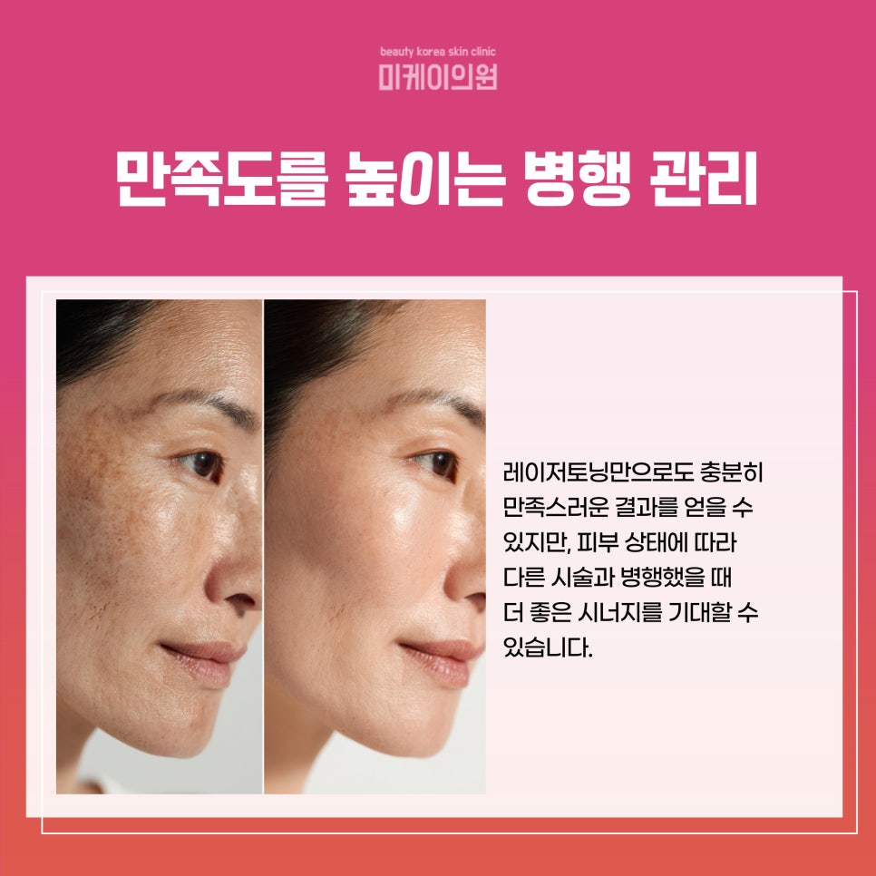 강남 피부과 레이저토닝 깨끗하고 환한 피부의 시작 관련 이미지 5