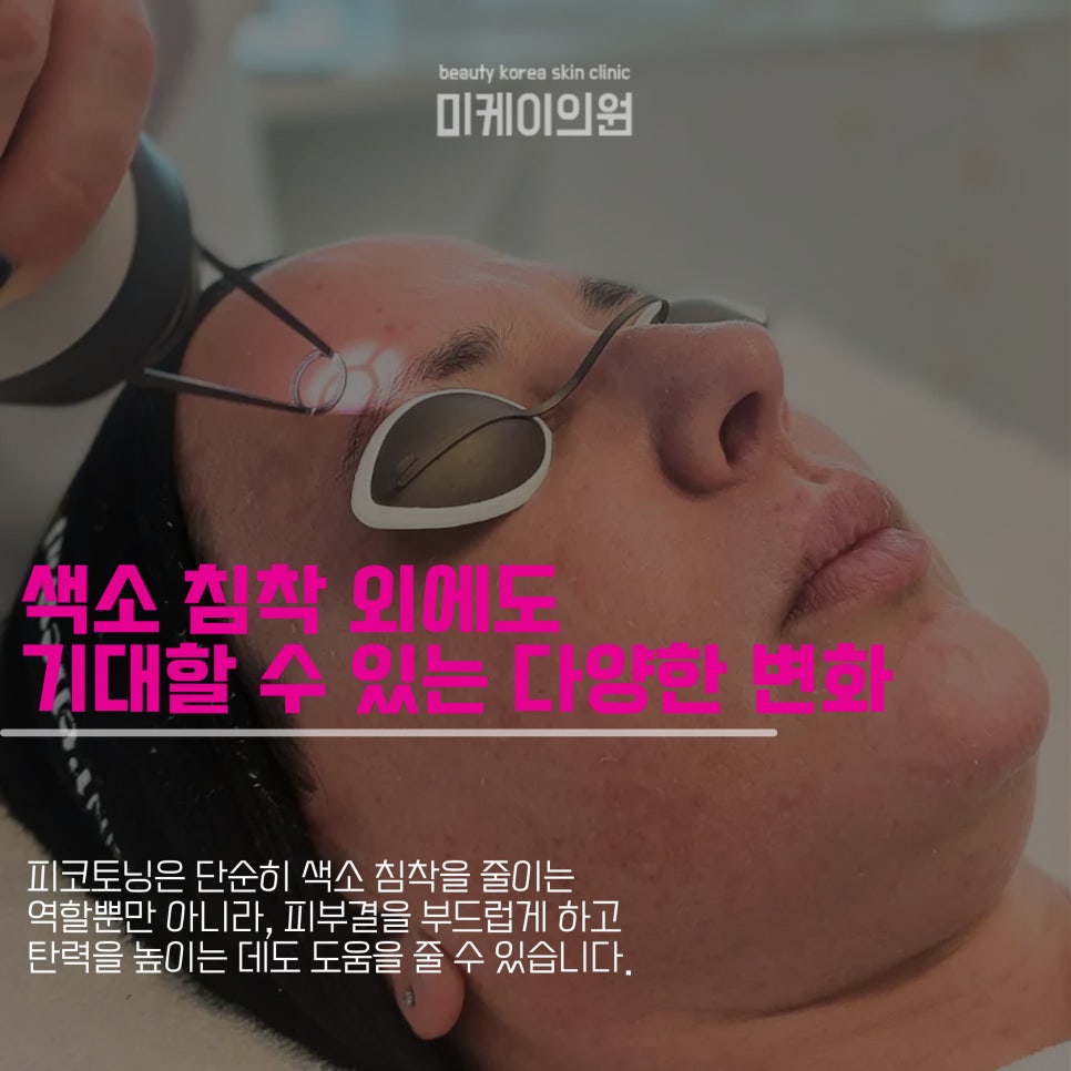 강남 피코토닝 효과가 궁금하다면 관련 이미지 3