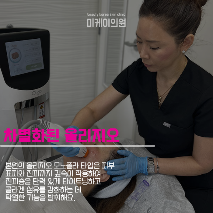 Oligio Treatment Intervals for a Smooth Facial Line image 4