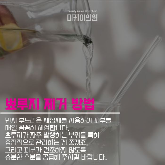 뾰루지나는이유 및 제거 방법 관련 이미지 3