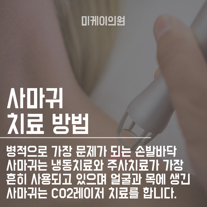 강남점사마귀피부과 피부의 옥에 티 없애기 관련 이미지 3