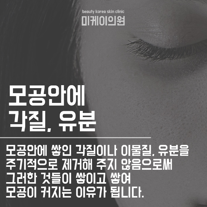 강남역 피부과 모공이 넓어지는 이유 제대로 알아봐요 관련 이미지 2