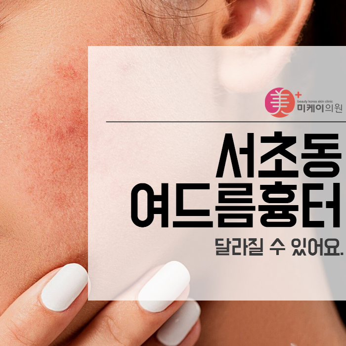 서초동여드름흉터 달라질 수 있어요. 관련 이미지 1