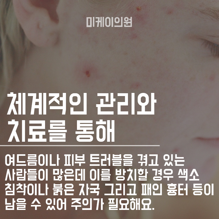 서초동여드름흉터 달라질 수 있어요. 관련 이미지 4