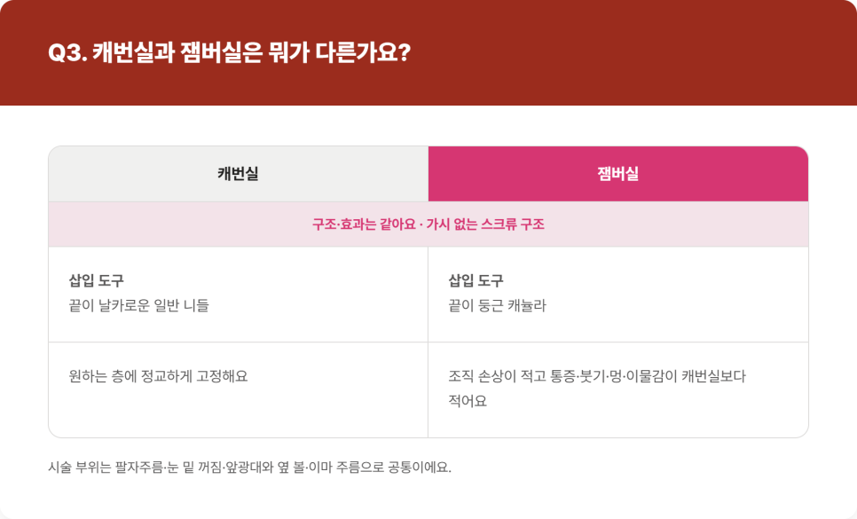 실리프팅 종류, 민트실&middot;캐번실&middot;잼버실&middot;엘라스티 포르테는 뭐가 다를까 관련 이미지 6