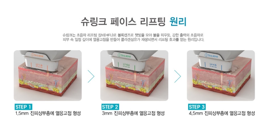 서초아이슈링크 미케이의원에서 눈가 탄력 개선 관련 이미지 6