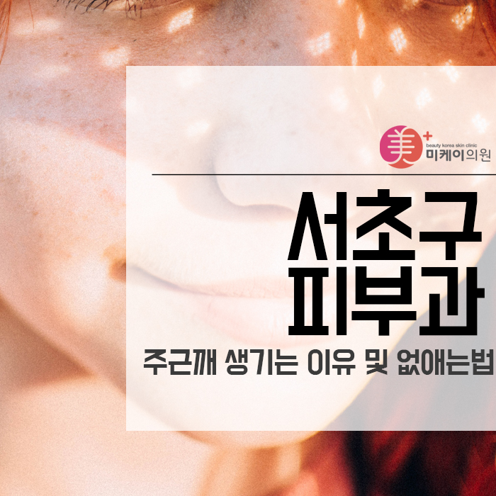 서초구피부과 주근깨 생기는 이유 및 없애는 법 관련 이미지 1