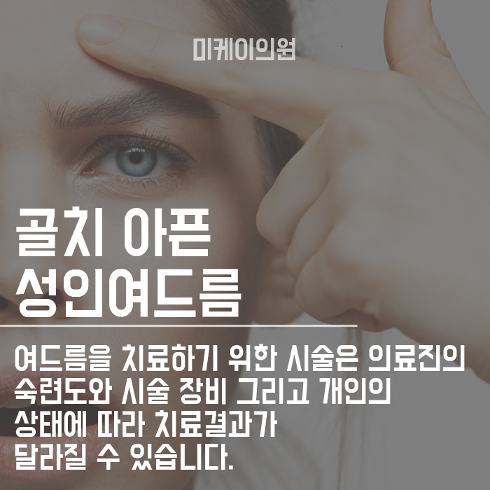 서초여드름의원 원인 그리고 치료방법에 대해 관련 이미지 3