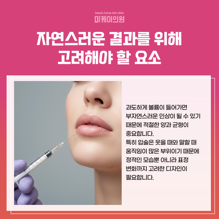 Where to Get Lip Fillers Near Gangnam Station: A Natural Design image 4