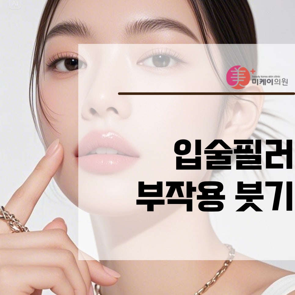 How to Avoid Swelling as a Lip Filler Side Effect image 1