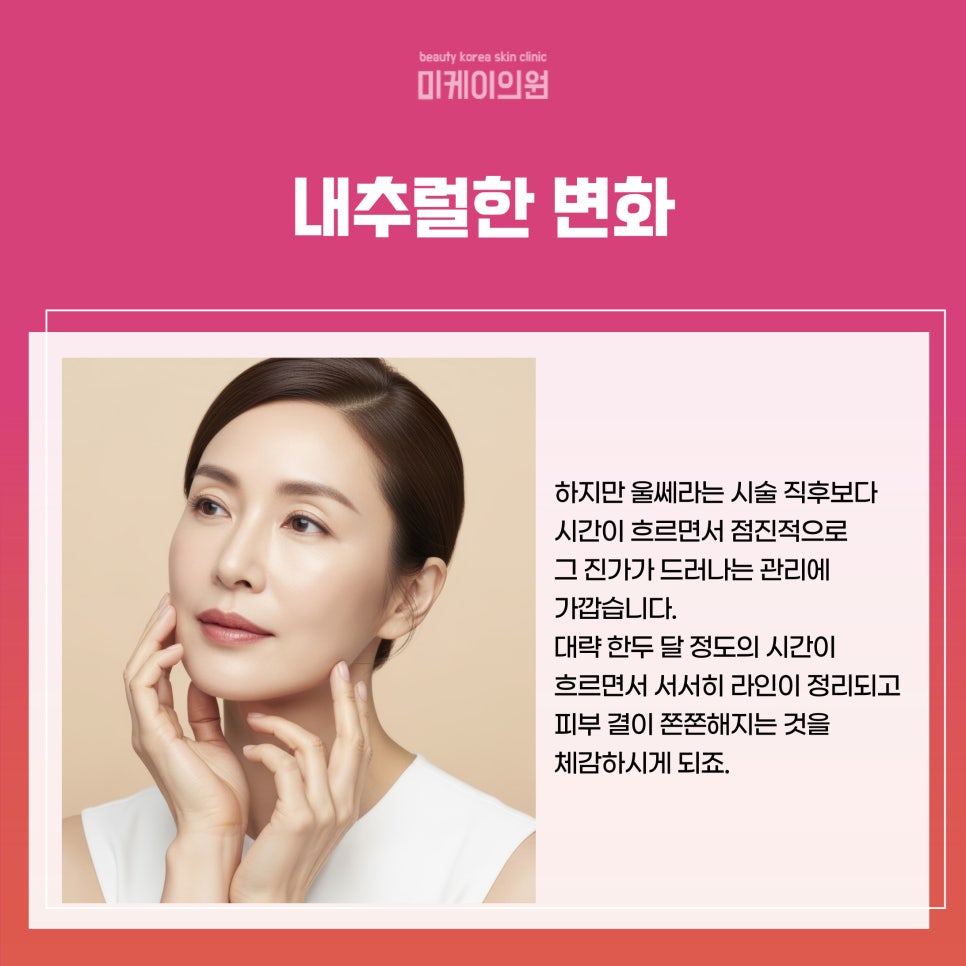 Where to Get Ulthera Done Well at a Dermatology Clinic Near Gangnam Station image 4