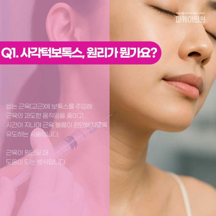 사각턱보톡스 효과 있는 사람, 따로 있을까? 관련 이미지 2