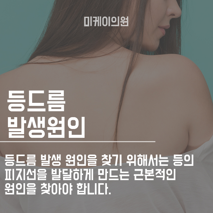 등드름 원인 안 보이는 곳도 중요하다 관련 이미지 2