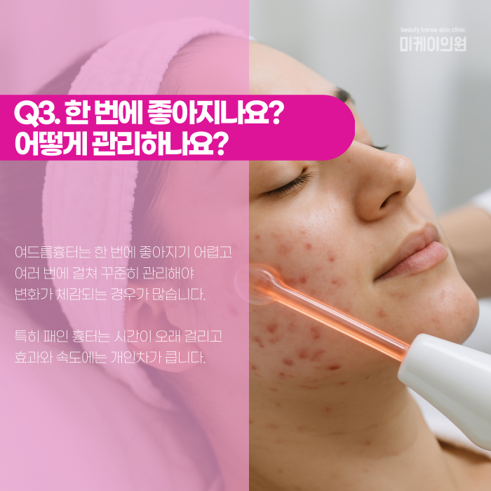 Why Don’t Gangnam Acne Scars Disappear on Their Own? image 4