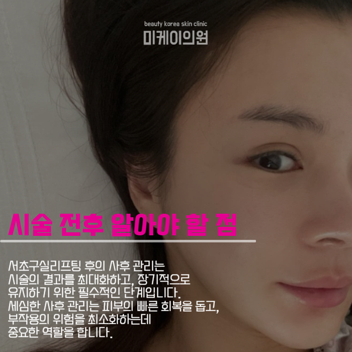 서초구실리프팅 처진 얼굴라인 관리해보세요 관련 이미지 3