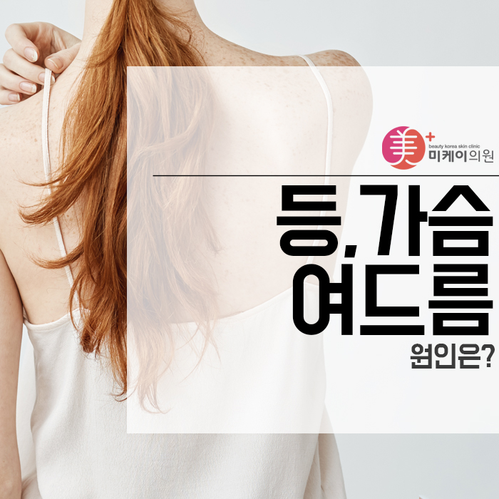등,가슴 여드름 원인은? 관련 이미지 1