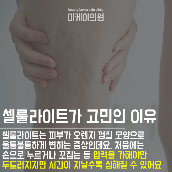 강남팔뚝지방분해주사 슬림한 라인 관련 이미지 4