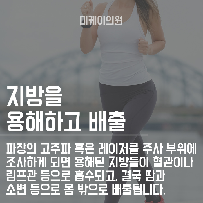 강남 바디라인주사HPL 뱃살에 맞고 운동하면 효과 관련 이미지 4