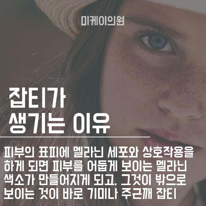 기미레이저토닝 관리 잡티 고민된다면 관련 이미지 2
