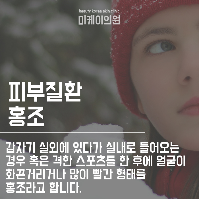 겨울철 피부질환 관리 꿀팁 알려드려요! 관련 이미지 3